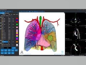 의료용 3D 재구성 및 3D 프린팅 서비스